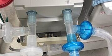 “Πατέντα” στο νοσοκομείο Βέροιας: Οξυγόνο σε τέσσερις με έναν αναπνευστήρα