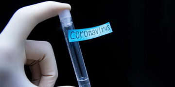 Κορονοϊός: Εξιτήριο από το ΑΧΕΠΑ για τον 50χρονo από την Σιάτιστα