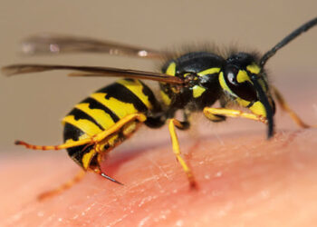 Πρώτες βοήθειες για τσίμπημα μέλισσας, σφήκας (σφίγγας ή σφήγκας). Πώς να αφαιρέσετε το κεντρί; Αντιμετώπιση αλλεργικής αντίδρασης