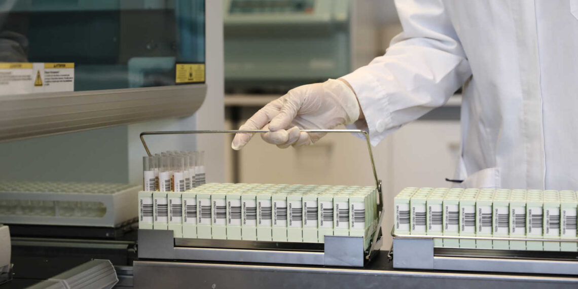 Κορονοϊός: Ευχάριστα νέα από την χορήγηση πλάσματος σε ασθενείς στην Ελλάδα