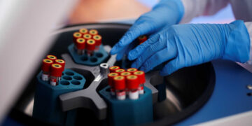 Τι συμβαίνει με τα 4 νέα κρούσματα στην Περιφερειακή Ενότητα Φλώρινας