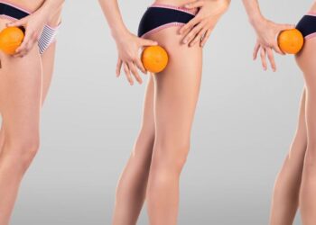 Αντιμετώπιση κυτταρίτιδας από τα ινστιτούτα αισθητικής στην Αγία Παρασκευή