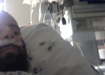 Κορωνοϊός: Ο 34χρονος Έλληνας που ξύπνησε από κώμα λόγω του ιού απαντά στους αρνητές