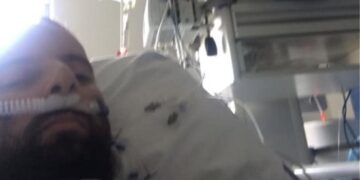 Κορωνοϊός: Ο 34χρονος Έλληνας που ξύπνησε από κώμα λόγω του ιού απαντά στους αρνητές