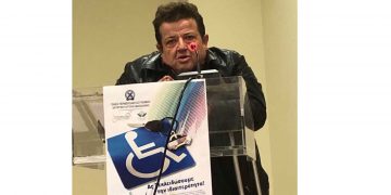 Πλειοψήφησε ο Μιχάλης Μήγγος στις εκλογές της Περιφερειακής Ομοσπονδίας Ατόμων με Αναπηρία: “Συνεχίζω τον δύσκολο αγώνα”