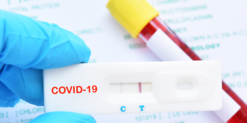 Δωρεάν ατομικά rapid test: Μαζικά κατ’ οίκον τεστ για τον έλεγχο της πανδημίας