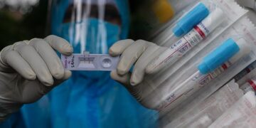 Self testing: Τι είναι και πώς θα το κάνουμε στο σπίτι – Τα υπέρ και τα κατά