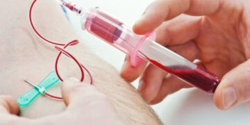 Υπηρεσία Αιμοδοσίας του  Γ.Ν. Κοζάνης: Αιμοληψίες στην κεντρική πλατεία Κοζάνης από Δευτέρα έως Παρασκευή  