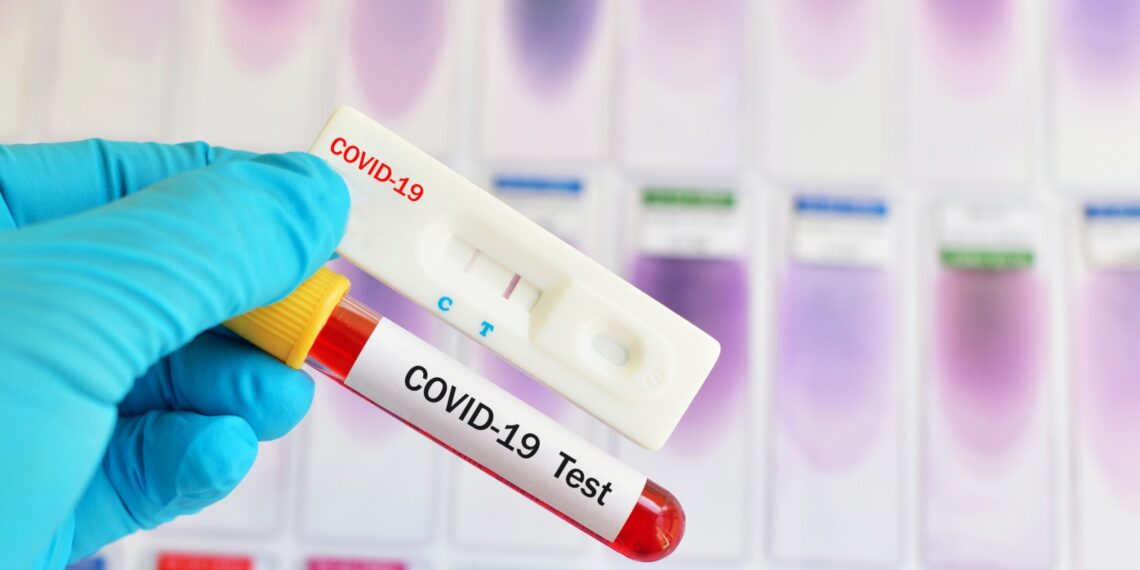 Δωρεάν έλεγχοι rapid test από ΚΟΜΥ Καστοριάς στη ΒΕΡΓΑ την Πέμπτη 20 Μαΐου