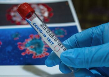 Μεγάλη ταλαιπωρία συμπολίτη μας για ένα τεστ covid, από το ΚΥ Πτολεμαΐδας