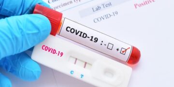 Δήμος Γρεβενών: Δωρεάν rapid test κάτω από το Δημαρχείο την Πέμπτη 20 Μαΐου