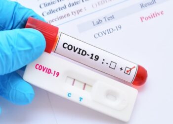 Κοζάνη: Rapid tests για την covid19 την Παρασκευή 7 Μαΐου, 10:00 – 13:00, στην κεντρική πλατεία