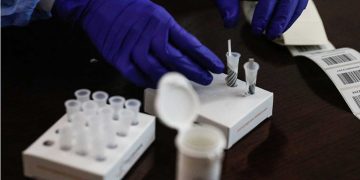 Πιστοποιητικό νόσησης: Τι ισχύει με την άδεια εργαζομένου, χρειάζεται PCR ή Rapid test;