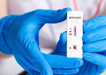 Δήμος Βελβεντού: Δωρεάν έλεγχος Rapid Tests για τους κατοίκους την Τρίτη 27 Σεπτεμβρίου