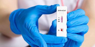 Δήμος Βελβεντού: Δωρεάν έλεγχος Rapid Tests για τους κατοίκους την Τρίτη 27 Σεπτεμβρίου