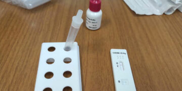 Δήμος Κοζάνης: Rapid tests στην κεντρική πλατεία την Τετάρτη 21 Δεκεμβρίου