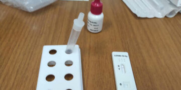 Δήμος Κοζάνης: Rapid tests στην κεντρική πλατεία την Τετάρτη 25 Ιανουαρίου από τις 10:00 έως τις 13:00
