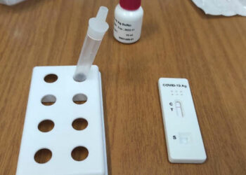 Δήμος Κοζάνης: Rapid tests στην κεντρική πλατεία την Τετάρτη 8 Φεβρουαρίου