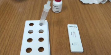 Δήμος Κοζάνης: Rapid tests στην κεντρική πλατεία την Τετάρτη 8 Φεβρουαρίου