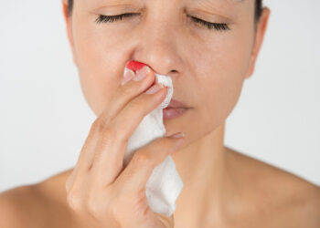 Γιατί ματώνει η μύτη; Τι να κάνετε στη ρινορραγία, επίσταξη για να σταματήσει να τρέχει αίμα; (video)