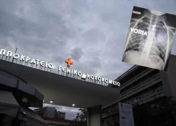 Θεσσαλονίκη: Αγοράκι 4,5 ετών κατάπιε σκυλάκι από επιτραπέζιο – Σωτήρια επέμβαση στο Ιπποκράτειο