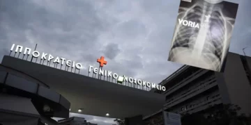 Θεσσαλονίκη: Αγοράκι 4,5 ετών κατάπιε σκυλάκι από επιτραπέζιο – Σωτήρια επέμβαση στο Ιπποκράτειο