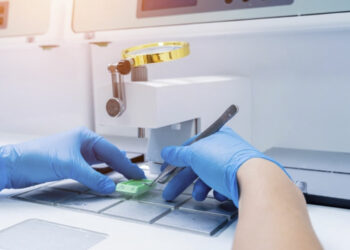 Κύπρος: Γυναίκα διαγνώστηκε με μεταστατικό καρκίνο από λάθος - Υποβλήθηκε σε χημειοθεραπείες, ενώ της έδωσαν 6 μήνες προσδόκιμο ζωής