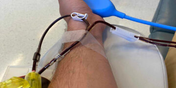 Έκκληση για συμμετοχή στην αυριανή αιμοδοσία της “Σταγόνας Ελπίδας” στην κεντρική πλατεία Κοζάνης