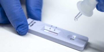 ΔΗΜΟΣ ΒΕΛΒΕΝΤΟΥ: Δωρεάν Rapid tests την  Τρίτη 30 Ιανουαρίου 2024