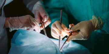 Η πρώτη μεταμόσχευση ήπατος από ζώντα δότη έγινε στην Ελλάδα