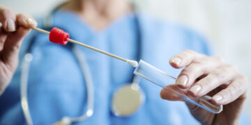 Στρεπτόκοκκος: Και 28χρονος νεκρός – Έρχεται έξαρση, τι πρέπει να προσέχουμε