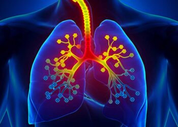 Βρογχίτιδα οξεία και χρόνια με βήχα και απόχρεμψη. Πώς αντιμετωπίζεται; Ροφήματα που κάνουν καλό.