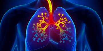 Βρογχίτιδα οξεία και χρόνια με βήχα και απόχρεμψη. Πώς αντιμετωπίζεται; Ροφήματα που κάνουν καλό.