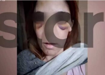 Αργος:«Δεν έχω κάνει κάτι, ήταν οι πράξεις της που την τιμωρήσανε» - Προκαλεί ο 34χρονος που χτύπησε με σίδερο τη σύζυγό του