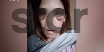 Αργος:«Δεν έχω κάνει κάτι, ήταν οι πράξεις της που την τιμωρήσανε» - Προκαλεί ο 34χρονος που χτύπησε με σίδερο τη σύζυγό του