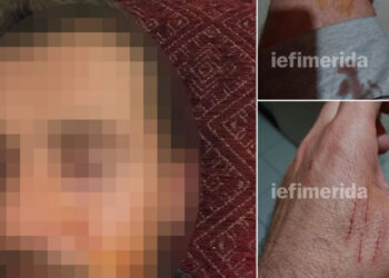 Κορινθία: Ζευγάρι σε διάσταση έβγαλε τα κουζινομάχαιρα και κατέληξαν αμφότεροι με χειροπέδες