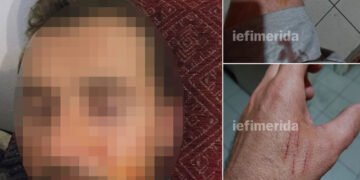 Κορινθία: Ζευγάρι σε διάσταση έβγαλε τα κουζινομάχαιρα και κατέληξαν αμφότεροι με χειροπέδες