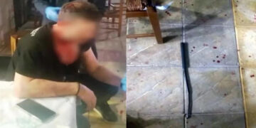 Αγρίνιο: Δεν τους άρεσε το φαγητό και λύγισαν σιδερένιο γκλοπ στο κεφάλι του εστιάτορα