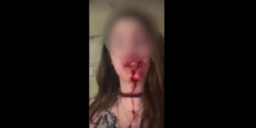 Άμφισσα: Κατήγγειλε με αίματα στο πρόσωπο ότι την ξυλοκόπησε ο σύζυγός της -«Θα σε βρει ο πατέρας σου στον κάδο»