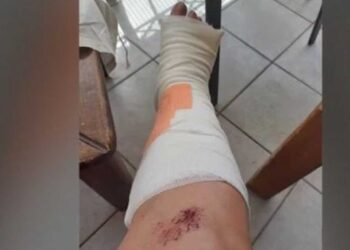 Θεσσαλονίκη: Γυναίκα υπέστη πολλαπλά κατάγματα όταν υποχώρησε το οδόστρωμα - "Άνοιξε ο δρόμος και την κατάπιε" (βίντεο)