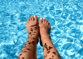 Πως το νερό της πισίνας επηρεάζει την επιδερμίδα σου - Συμβουλές για προστασία