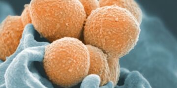 Στρεπτόκοκκος: Τι πρέπει να προσέχουν οι γονείς για παιδιά έως 12 ετών