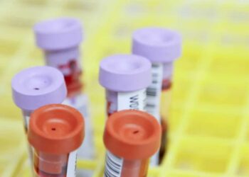 Έρχονται SMS σε 5,5 εκατ. πολίτες για εξετάσεις χοληστερίνης