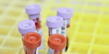 Έρχονται SMS σε 5,5 εκατ. πολίτες για εξετάσεις χοληστερίνης