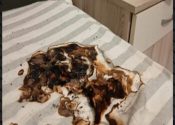 Κινητό τηλέφωνο έσκασε ενώ φόρτιζε – Τραυματίστηκε ο ιδιοκτήτης του, πήρε φωτιά το κρεβάτι