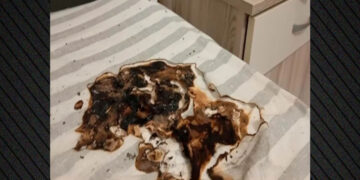 Κινητό τηλέφωνο έσκασε ενώ φόρτιζε – Τραυματίστηκε ο ιδιοκτήτης του, πήρε φωτιά το κρεβάτι