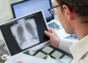 Θεσσαλονίκη: Αυξήθηκαν κατά 54% τα περιστατικά φυματίωσης