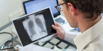 Θεσσαλονίκη: Αυξήθηκαν κατά 54% τα περιστατικά φυματίωσης