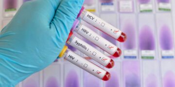 Εκδήλωση πρόληψης και ελέγχου για τα Σεξουαλικώς Μεταδιδόμενα Νοσήματα από το Κ.Υ. Πτολεμαΐδας στις 13/3