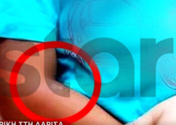 Φρίκη στη Λάρισα: Έσβηνε τσιγάρα πάνω στο κορμί των δύο παιδιών της